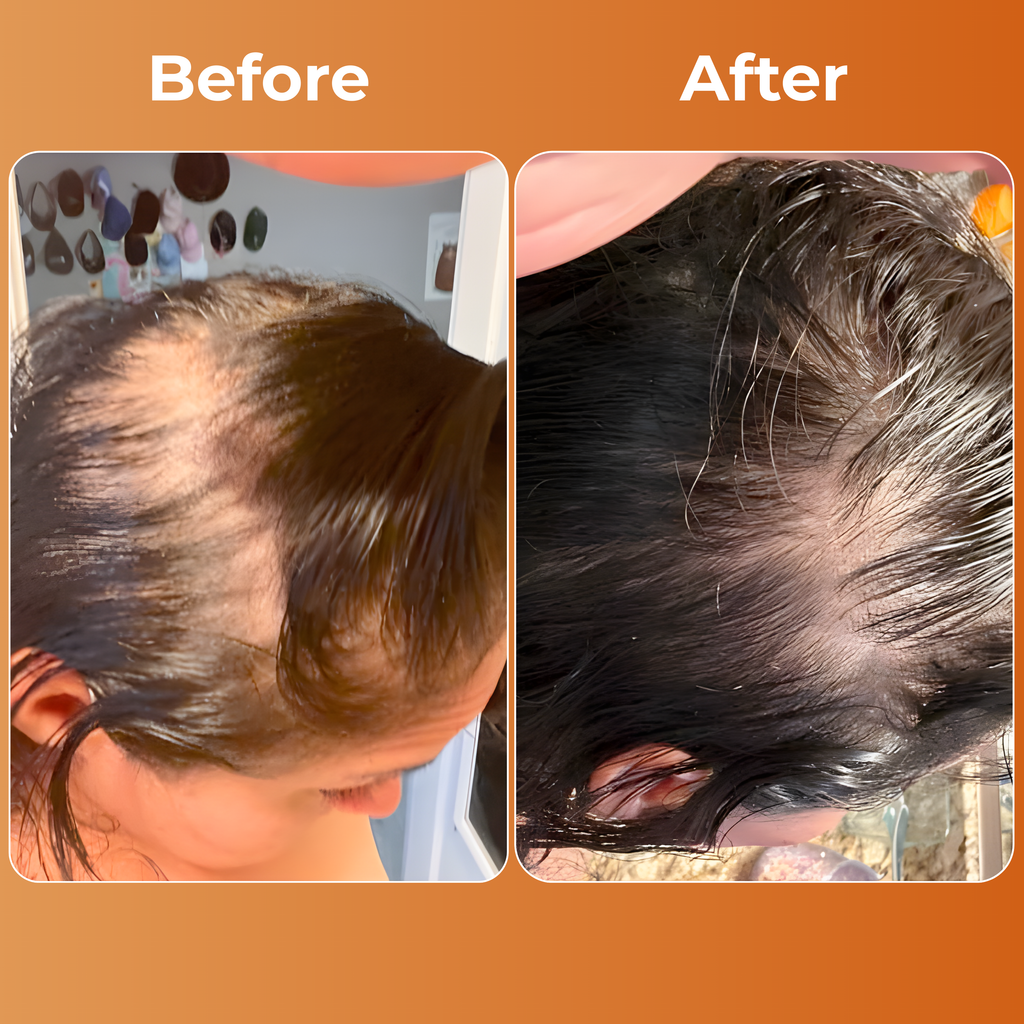 ALOVIA™ –Pumpkin Seed Oil, Natural Support for Hair Growth - Bladder Health